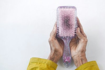 Opeens bosjes haar verliezen is vaker stress dan je denkt